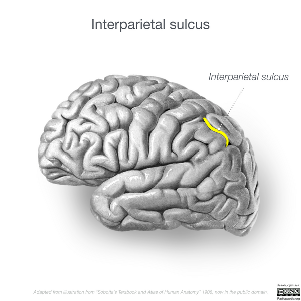 File:Neuroanatomy- lateral cortex (diagrams) (Radiopaedia 46670-51202 Interparietal sulcus 1).png