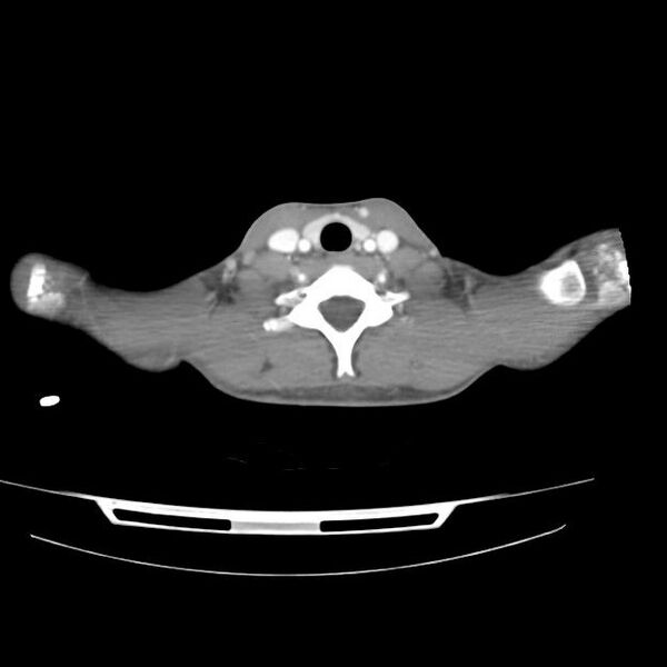 File:Normal dual-phase trauma CT chest,abdomen and pelvis (Radiopaedia 48092-52899 A 1).jpg