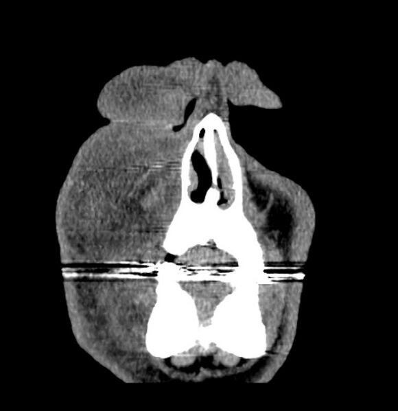 File:Necrobiotic xanthogranuloma- face (Radiopaedia 29549-30052 A 2).jpg