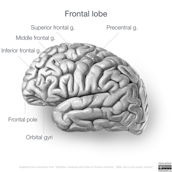 File:Neuroanatomy- lateral cortex (diagrams) (Radiopaedia 46670-51313 Frontal lobe gyri 3).png