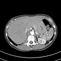 Normal multiphase CT liver (Radiopaedia 38026-39996 B 18).jpg