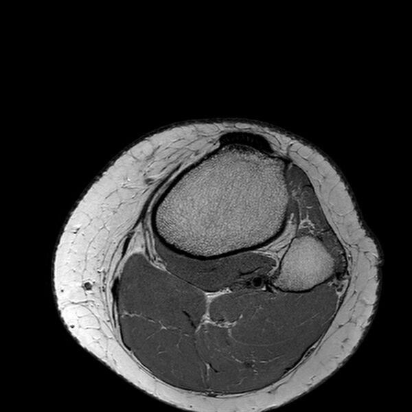 File:Anatomy Quiz (MRI knee) (Radiopaedia 43478-46866 A 27).jpeg