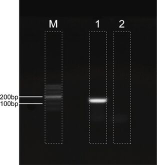 Human polyomavirus 2 detection by PCR. Lane 1: 129-bp PCR product of the primer,Lane M: DNA ladder, Lane 2: Negative control