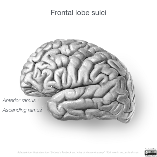 File:Neuroanatomy- lateral cortex (diagrams) (Radiopaedia 46670-51202 C 2).png