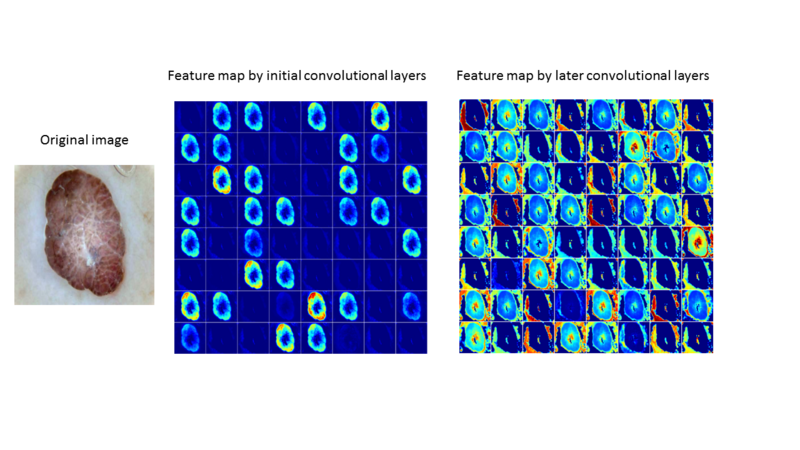 File:Typical feature maps learned using convolutional neural networks. (DermNet NZ Fig2).png