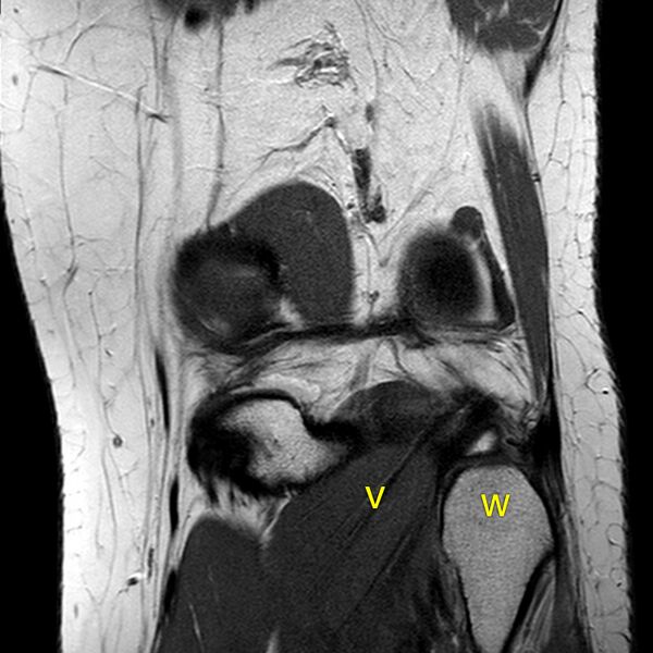 File:Anatomy Quiz (MRI knee) (Radiopaedia 43478-46874 A 24).jpeg