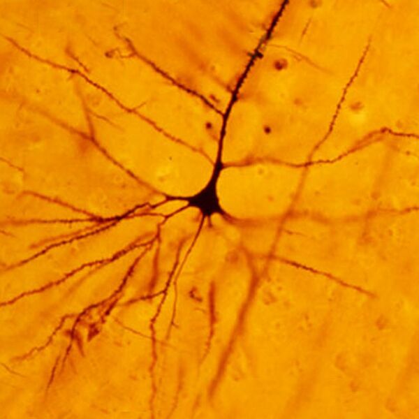 File:Betz cell of the primary motor cortex (histology) (Radiopaedia 36109).jpg