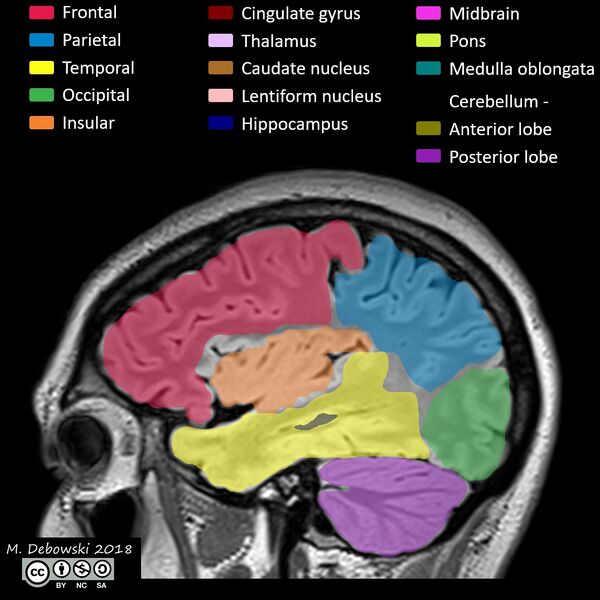 File:Brain lobes - annotated MRI (Radiopaedia 61691-69700 Sagittal 60).JPG