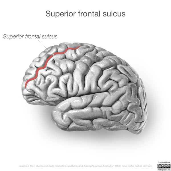 File:Neuroanatomy- lateral cortex (diagrams) (Radiopaedia 46670-51202 A 1).png