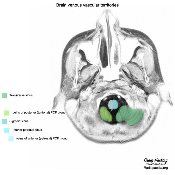 File:Brain venous vascular territories (diagram) (Radiopaedia 80107).jpeg