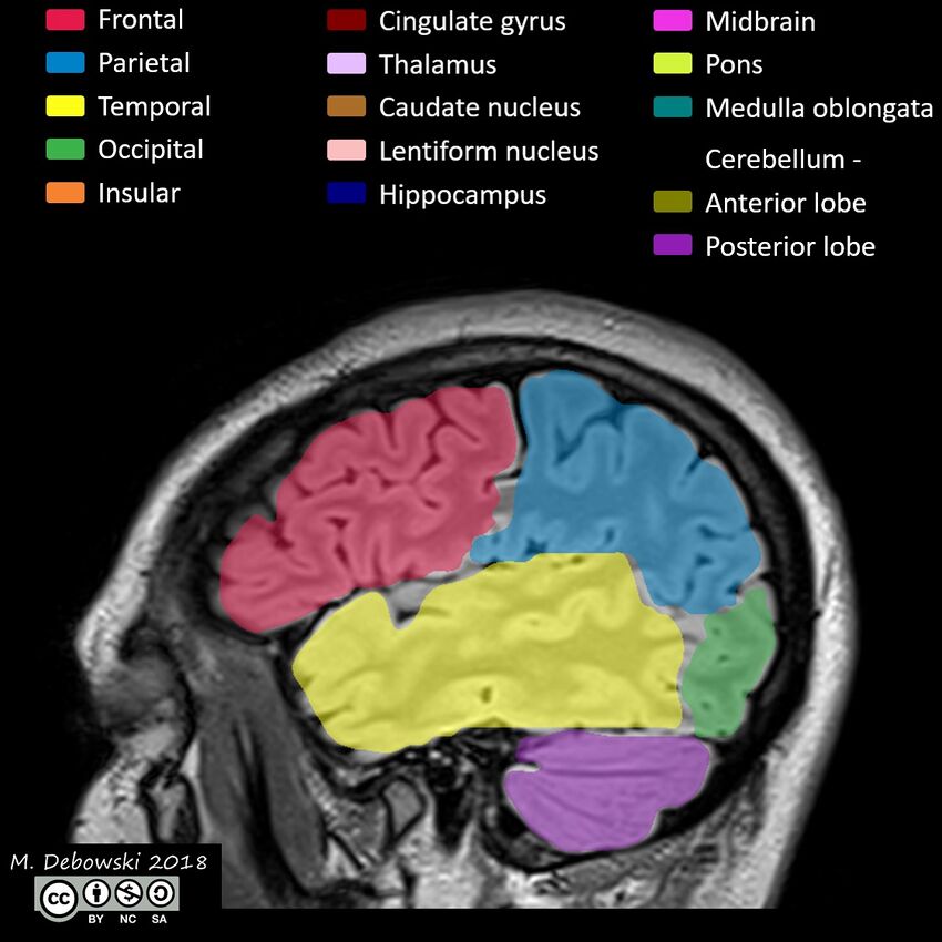 Brain lobes - annotated MRI (Radiopaedia 61691-69700 Sagittal 66).JPG