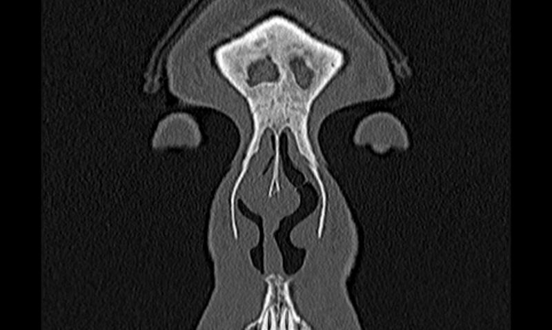 File:Chronic rhinosinusitis (Radiopaedia 65079-74075 Coronal bone window 1).jpg