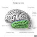Neuroanatomy- lateral cortex (diagrams) (Radiopaedia 46670-51156 Temporal lobe 6).png
