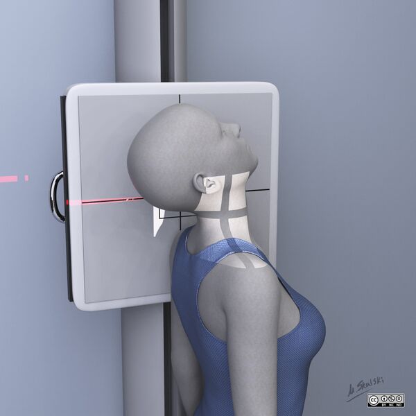 File:Cervical radiography - illustrations (Radiopaedia 80305-93667 None 4).jpg