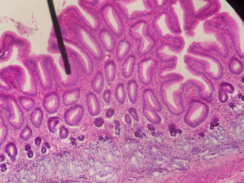 File:Normal stomach (pylorus) histology (Radiopaedia 36223).jpg