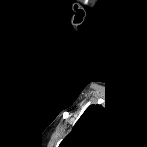 File:Normal CT of the neck (Radiopaedia 14575-14500 Sagittal C+ 4).jpg
