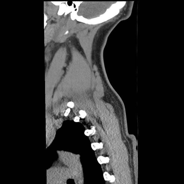 File:Normal trauma spine imaging (Radiopaedia 31753-32686 A 40).jpg