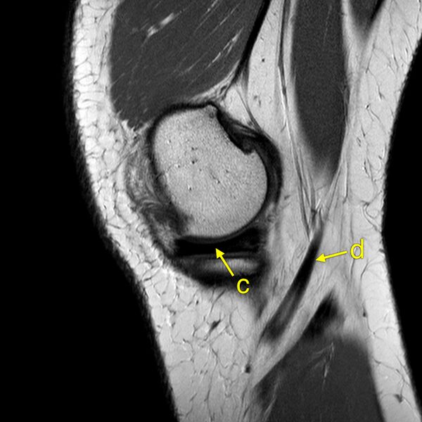 File:Anatomy Quiz (MRI knee) (Radiopaedia 43478-46865 A 3).jpeg