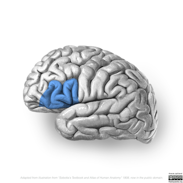 File:Neuroanatomy- lateral cortex (diagrams) (Radiopaedia 46670-51313 E 4).png
