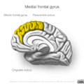 Neuroanatomy- medial cortex (diagrams) (Radiopaedia 47208-52697 Medial frontal gyrus 2).png
