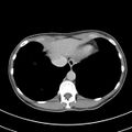 Normal multiphase CT liver (Radiopaedia 38026-39996 Axial C+ delayed 5).jpg