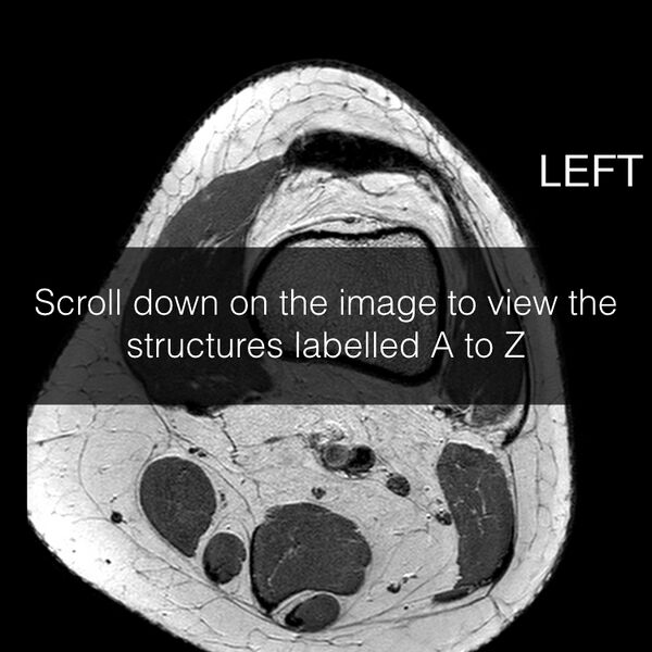 File:Anatomy Quiz (MRI knee) (Radiopaedia 43478-46866 A 1).jpeg