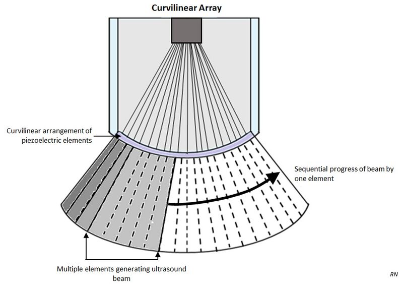 File:Curvilinear array (Radiopaedia 54645).jpg