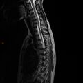 Normal spine MRI (Radiopaedia 77323-89408 E 8).jpg