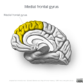 Neuroanatomy- medial cortex (diagrams) (Radiopaedia 47208-52697 Medial frontal gyrus 4).png