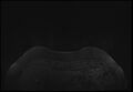 Normal breast MRI - dense breasts (Radiopaedia 80454-93850 Axial T1 4).jpg
