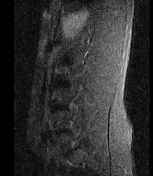 File:Normal lumbar spine MRI - low-field MRI scanner (Radiopaedia 40976-43699 Sagittal STIR 2).jpg