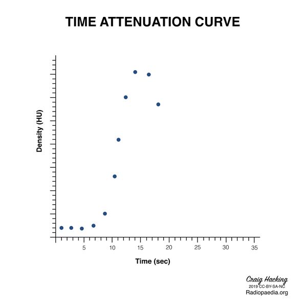 File:Brain perfusion - time attenuation curves (Radiopaedia 70313-80395 Curve generation 12).jpeg