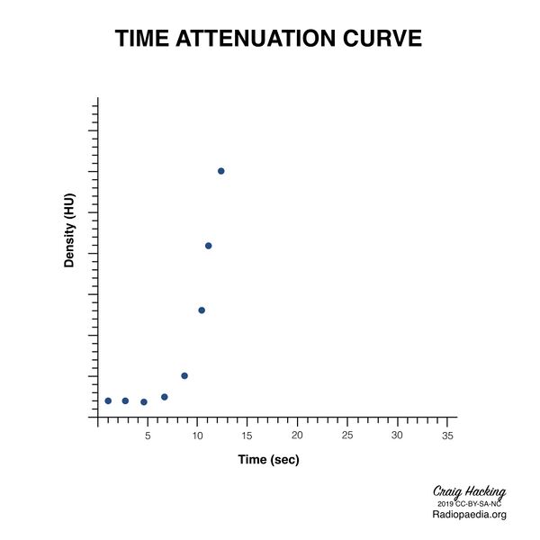 File:Brain perfusion - time attenuation curves (Radiopaedia 70313-80395 Curve generation 9).jpeg