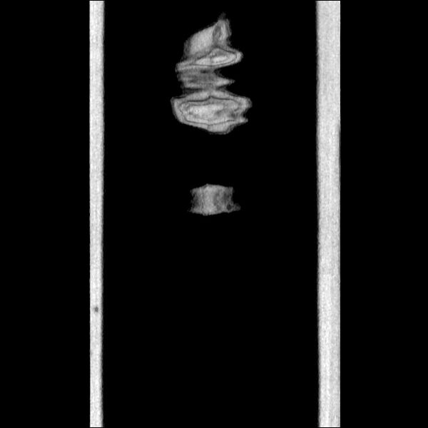 File:Normal CT angiogram of pelvis (Radiopaedia 45390-49430 B 53).jpg
