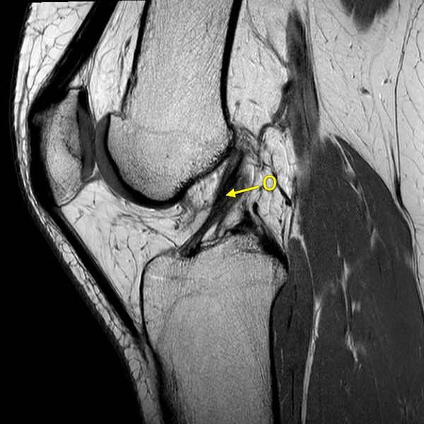 File:Anatomy Quiz (MRI knee) (Radiopaedia 43478-46865 A 14).jpeg