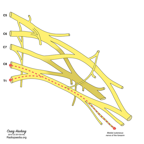 File:Brachial plexus (diagram) (Radiopaedia 37612-39492 K 1).png