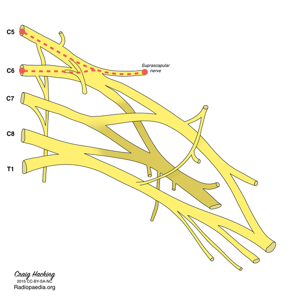 File:Brachial plexus (diagram) (Radiopaedia 37612-39492 Suprascapular nerve 1).png