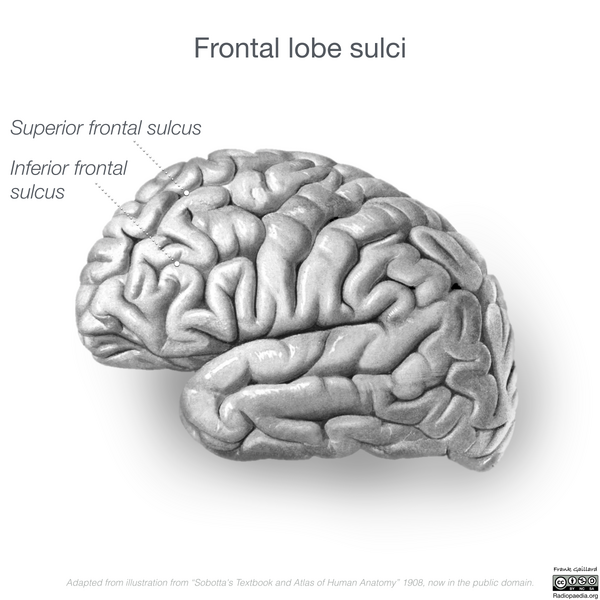 File:Neuroanatomy- lateral cortex (diagrams) (Radiopaedia 46670-51201 C 8).png