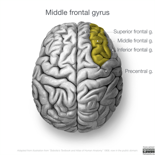 File:Neuroanatomy- superior cortex (diagrams) (Radiopaedia 59317-66670 Middle frontal gyrus 2).png