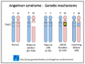 Angelman syndrome genetics (DermNet NZ 9579841Angelman-orig).png