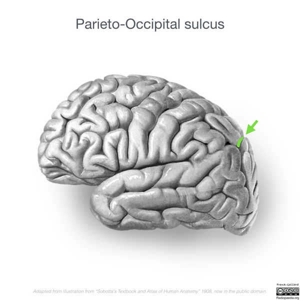 File:Neuroanatomy- lateral cortex (diagrams) (Radiopaedia 46670-51202 I 2).png