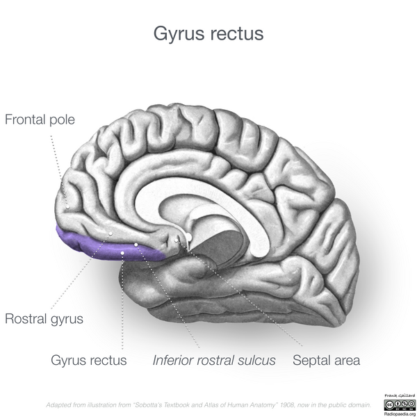 File:Neuroanatomy- medial cortex (diagrams) (Radiopaedia 47208-52697 Gyrus rectus 1).png