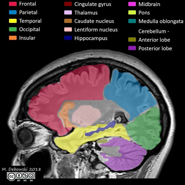 File:Brain lobes - annotated MRI (Radiopaedia 61691-69700 Sagittal 55).JPG