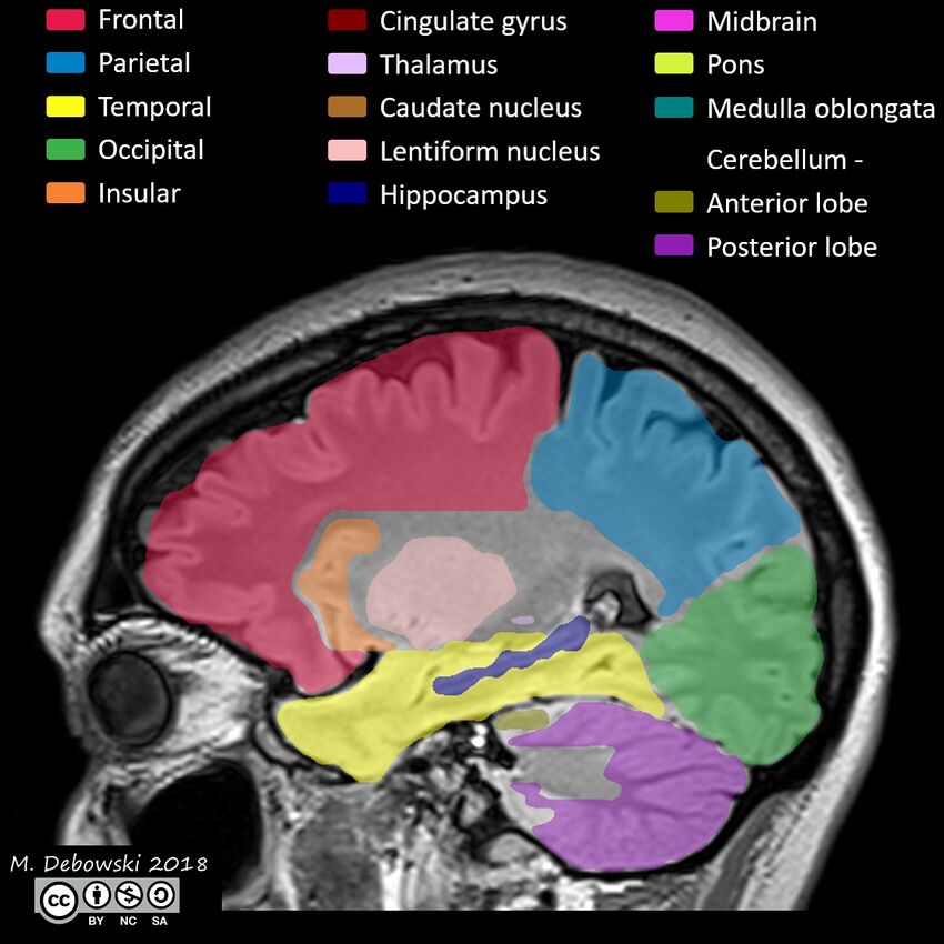 Brain lobes - annotated MRI (Radiopaedia 61691-69700 Sagittal 55).JPG