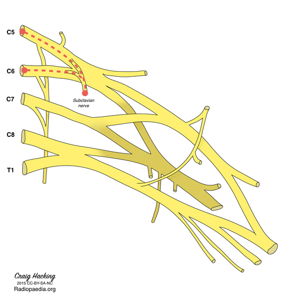 File:Brachial plexus (diagram) (Radiopaedia 37612-39492 Subclavian nerve 1).png