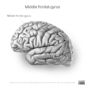 Neuroanatomy- lateral cortex (diagrams) (Radiopaedia 46670-51313 Middle frontal gyrus 2).png