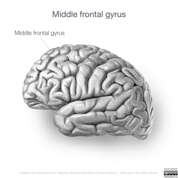File:Neuroanatomy- lateral cortex (diagrams) (Radiopaedia 46670-51313 Middle frontal gyrus 2).png