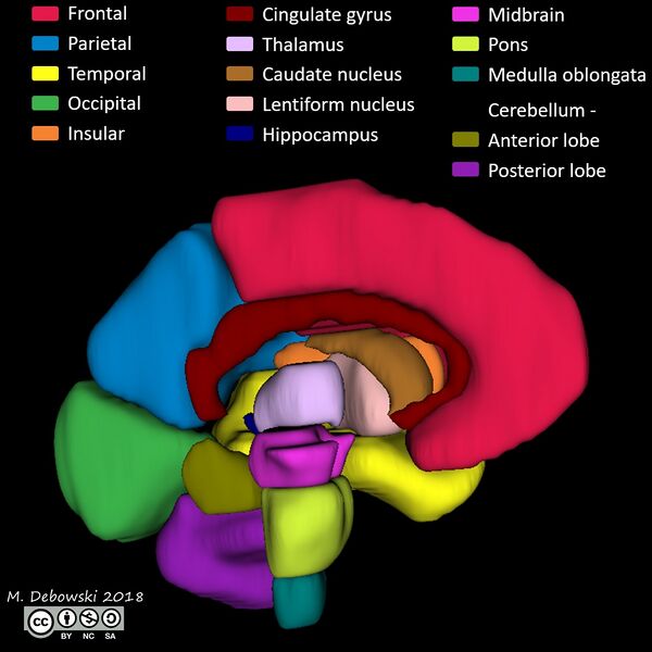 File:Brain lobes - annotated MRI (Radiopaedia 61691-69700 3D reconstruction 1).JPG