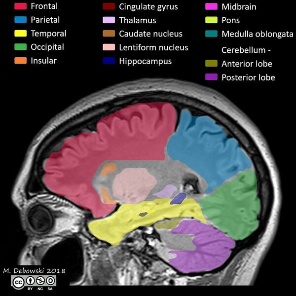 File:Brain lobes - annotated MRI (Radiopaedia 61691-69700 Sagittal 54).JPG