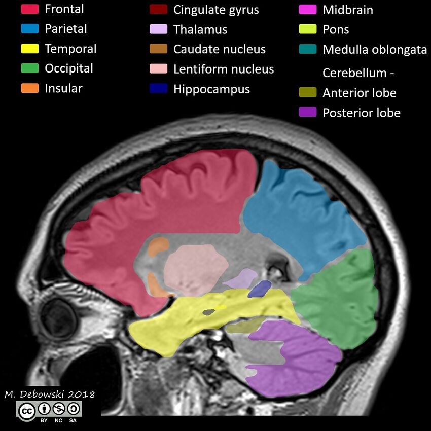 Brain lobes - annotated MRI (Radiopaedia 61691-69700 Sagittal 54).JPG